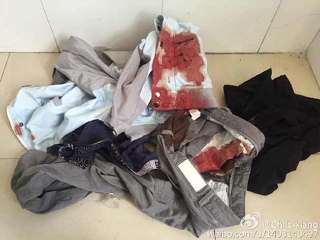 Chinese eSports player attacked by Didi driver, left wrist slashed